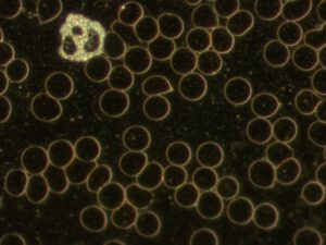 Dunkelfeld Blutanalyse