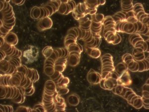 Dunkelfeld Blutanalyse