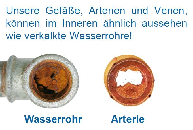 Bild Wasserrohr + Arterie